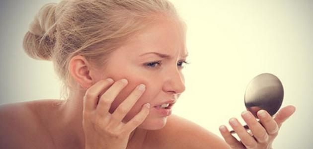 تونر للبشرة الدهنية