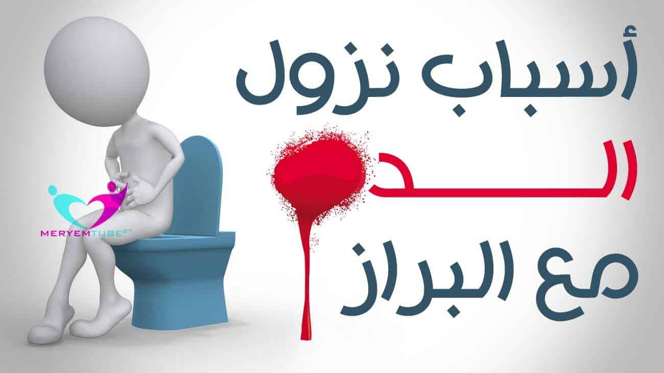 أسباب نزول الدم مع البراز واسرع طرق العلاج