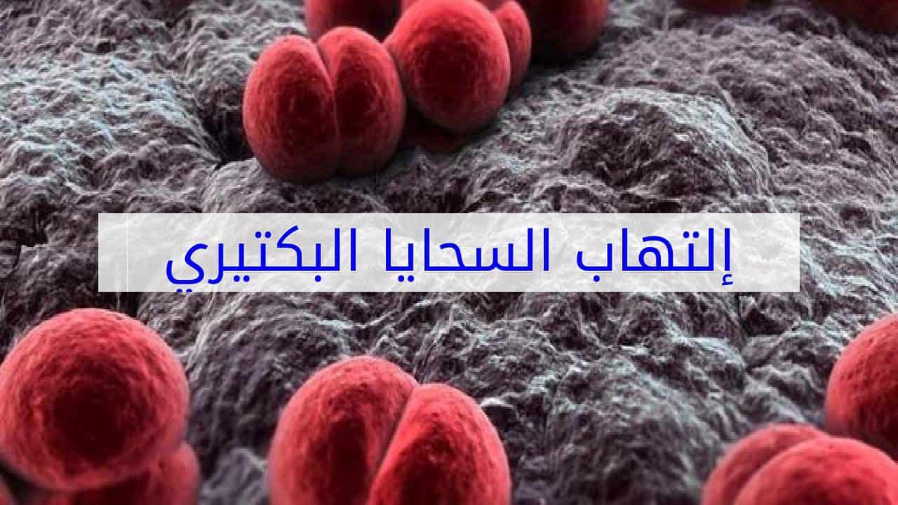 اعراض التهاب السحايا وانواعه وتشخيصه