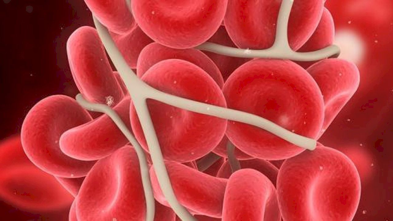 اعراض سرطان الدم عند النساء وافضل طرق علاجه