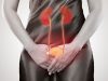 أعراض واسباب التهاب المسالك البولية عند النساء