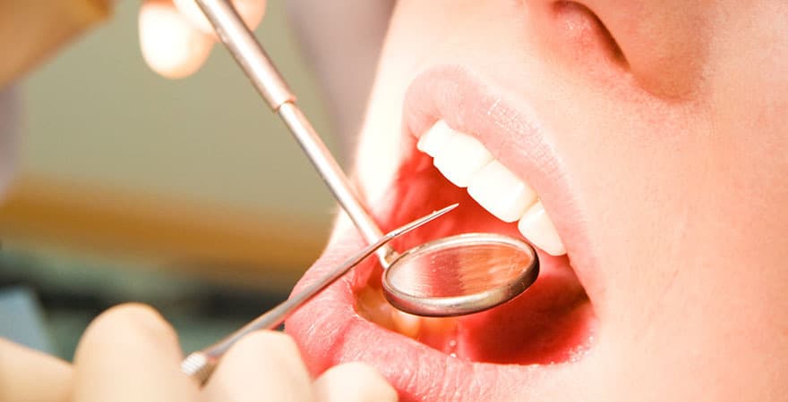 علاج الليوكوبلاكيا “سرطان الفم ” والوقايه منه