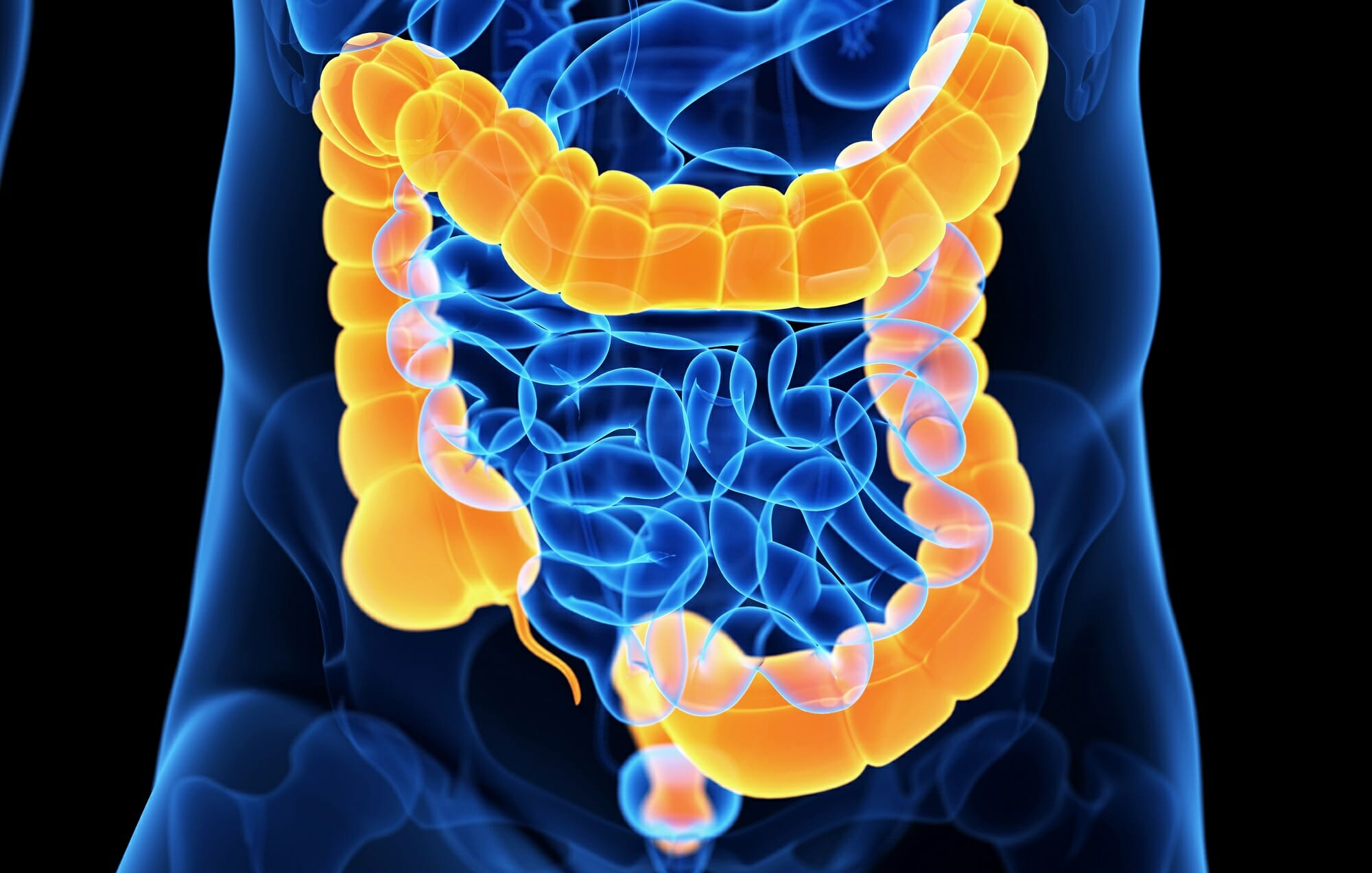 اعراض القولون العصبي بالتفصيل وعلاجه