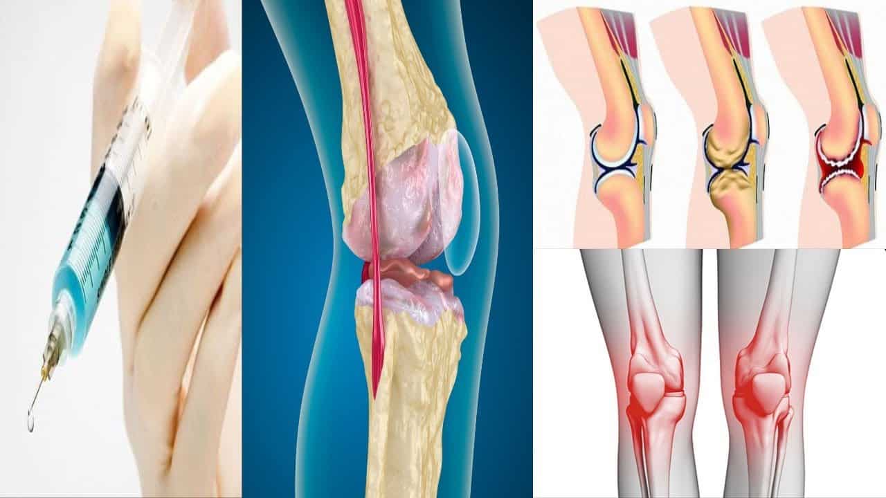 علاج احتكاك الركبة جابر القحطاني والطب النبوي مجرب سريع المعفول
