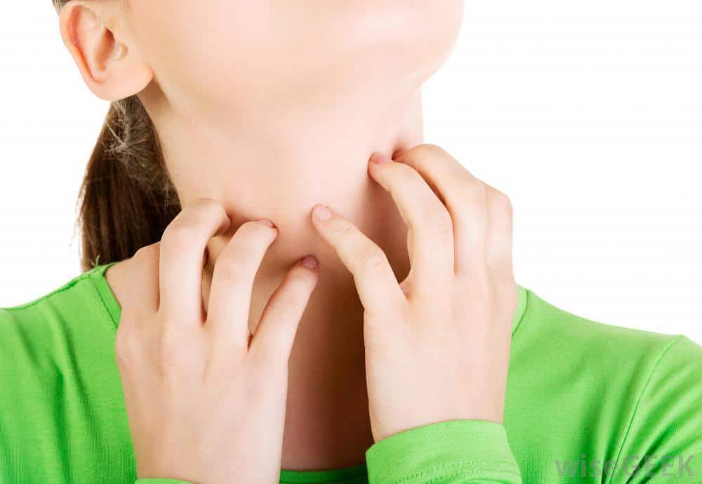 كيفية علاج حساسية الحلق والحنجرة ؟