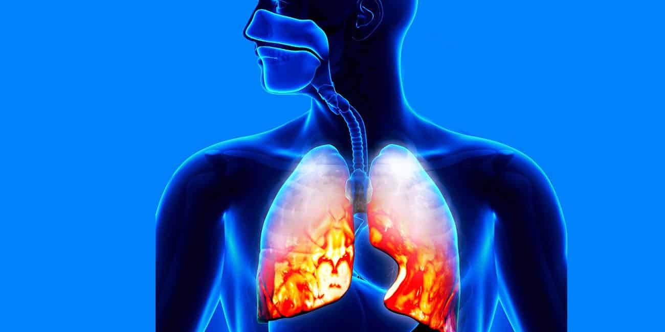 أعراض إلتهاب الرئة الحاد عند كبار السن وعلاجه