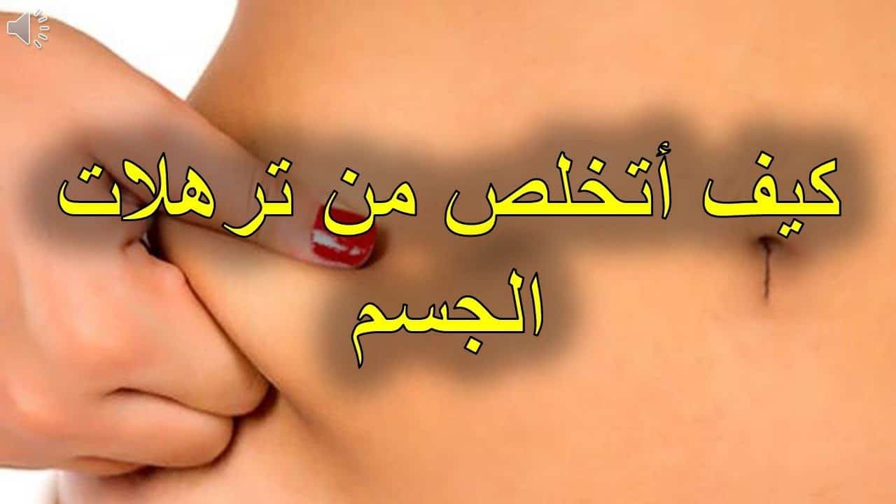 خلطات للتخلص من ترهلات الأرداف