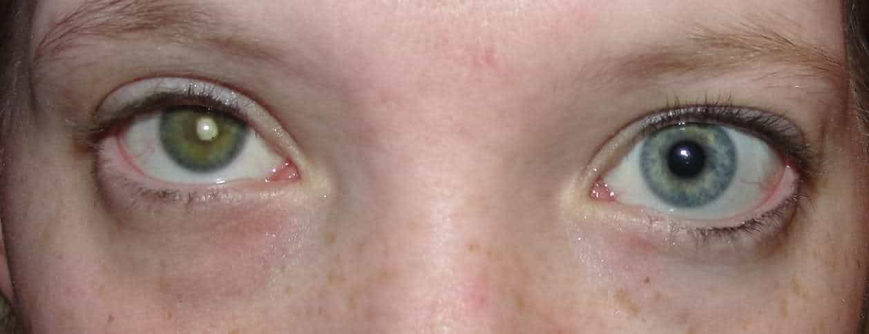 ما هو شعور شخص عاد اليه بصره ؟