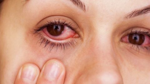 علاج حساسية العين القطرة سريعة المفعول