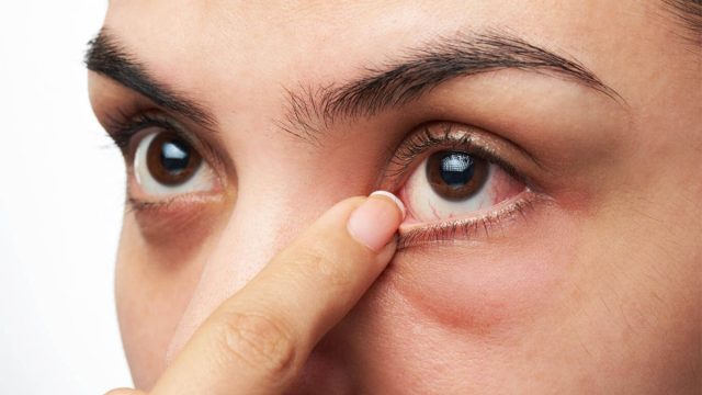 ما هي أسباب دخول العين للداخل وعلاجها ؟