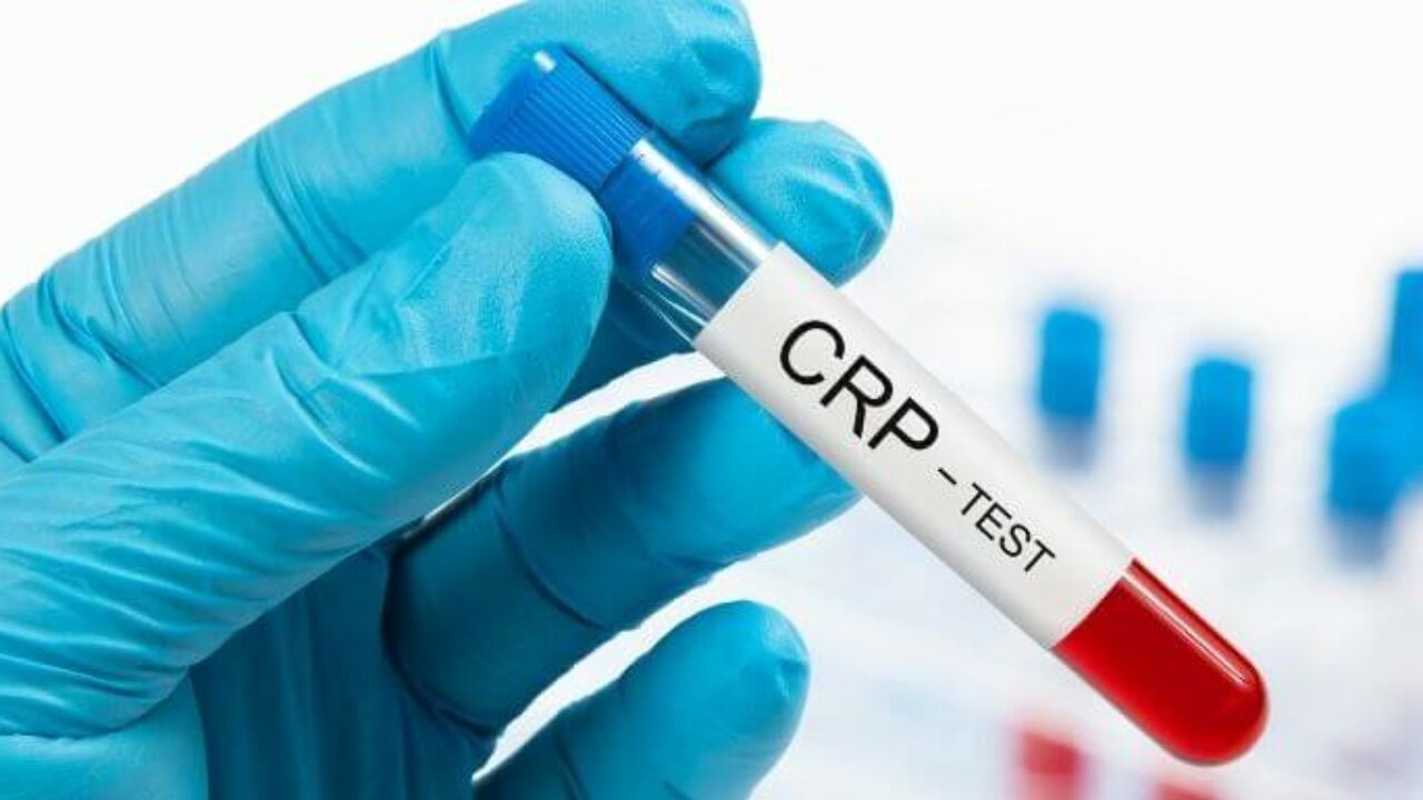 ما هو تحليل crp وشروطه ومضاعفاته ززز