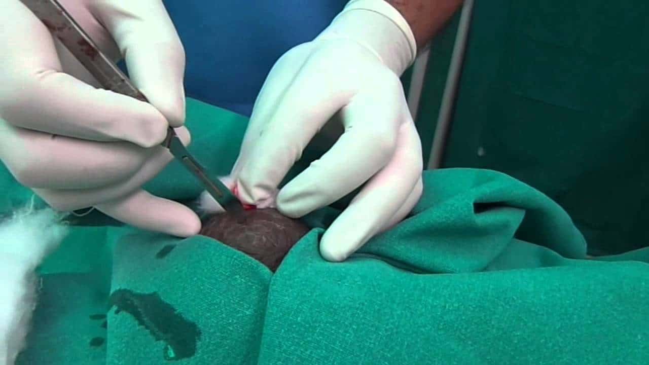 تجارب علاج الخراج تحت الابط