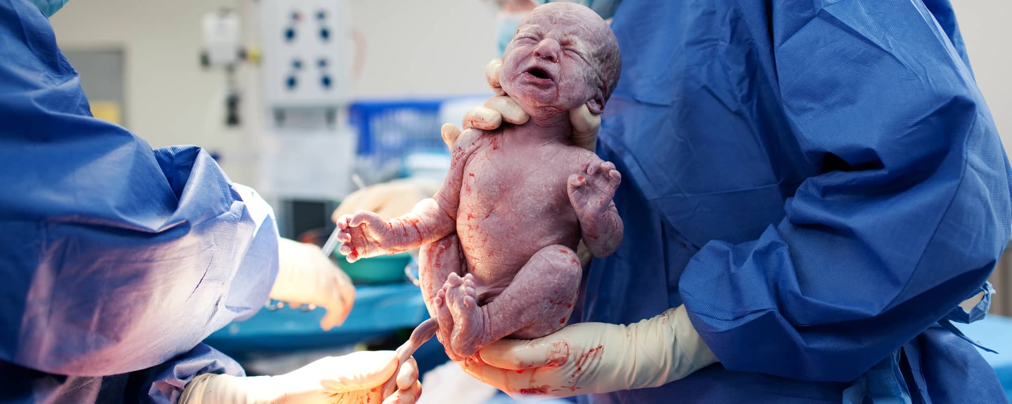 تفسير حلم الولادة القيصرية للعزباء - موسوعة