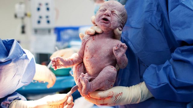 تفسير حلم الولادة القيصرية للعزباء