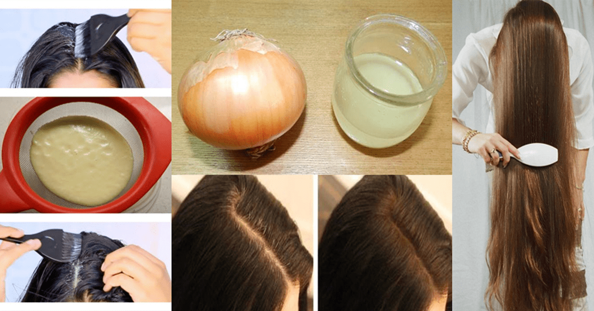 طريقة زراعة الشعر في المنزل