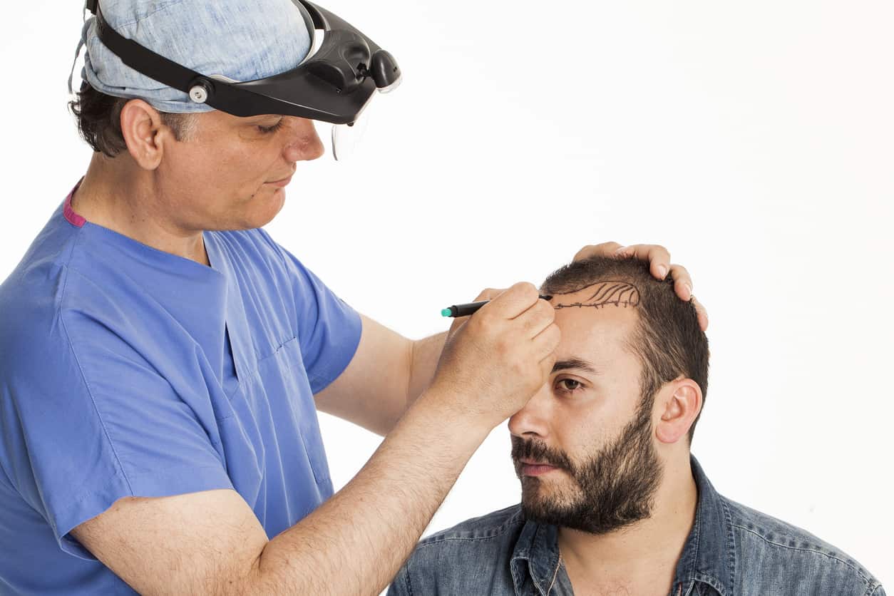 زراعة الشعر في الرياض التكلفة وافضل المراكز