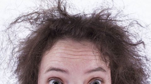 علاج تقصف الشعر من الأمام