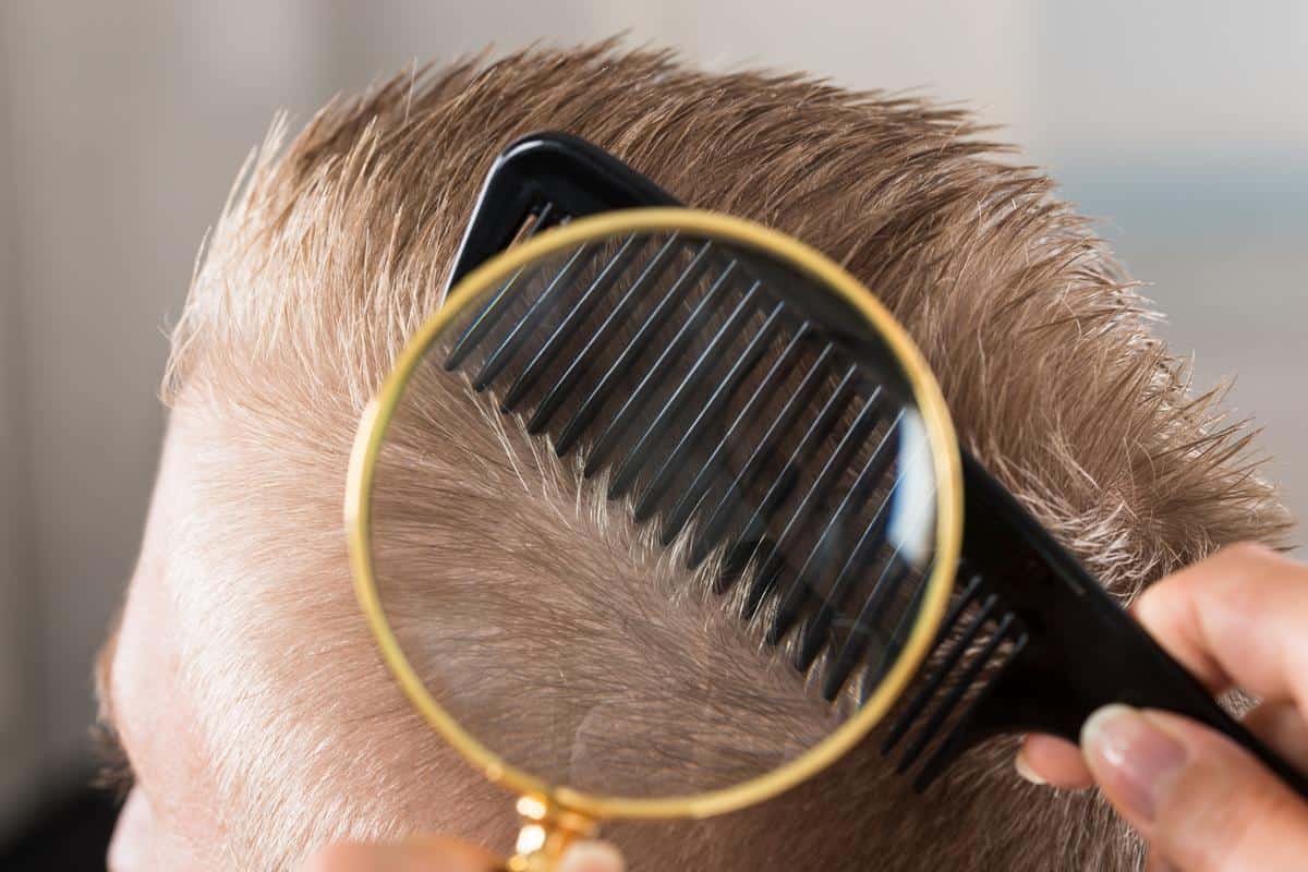 هل النفط يقتل القمل