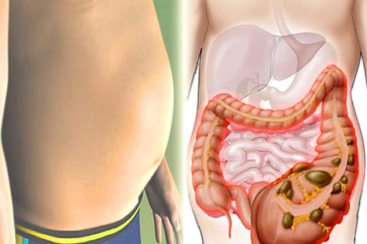 زه څنګه پوهیږم که زه په معده کې د مایع ساتل لرم؟