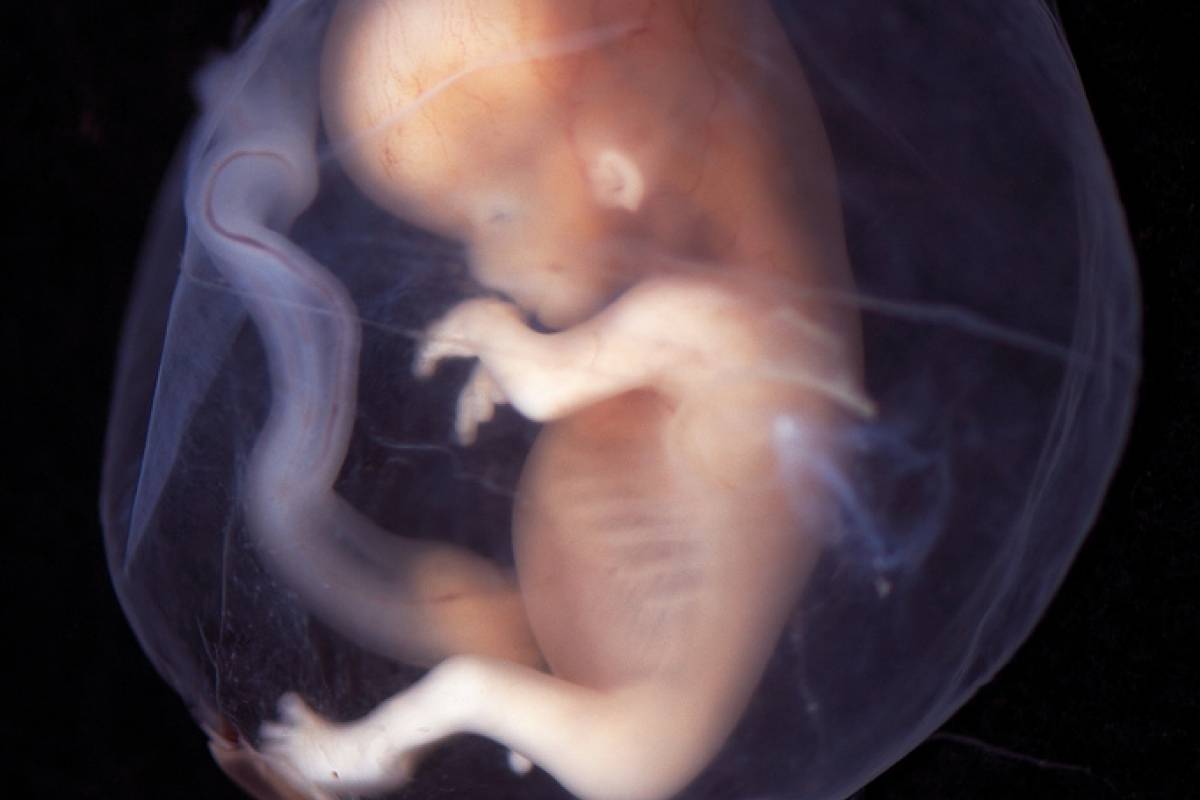 متى يظهر نبض الجنين بوضوح