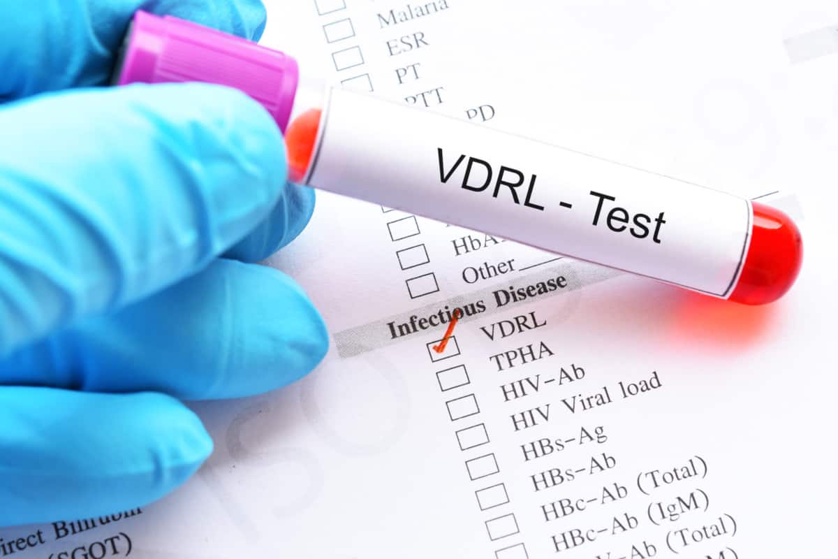 طريقة عمل تحليل vdrl