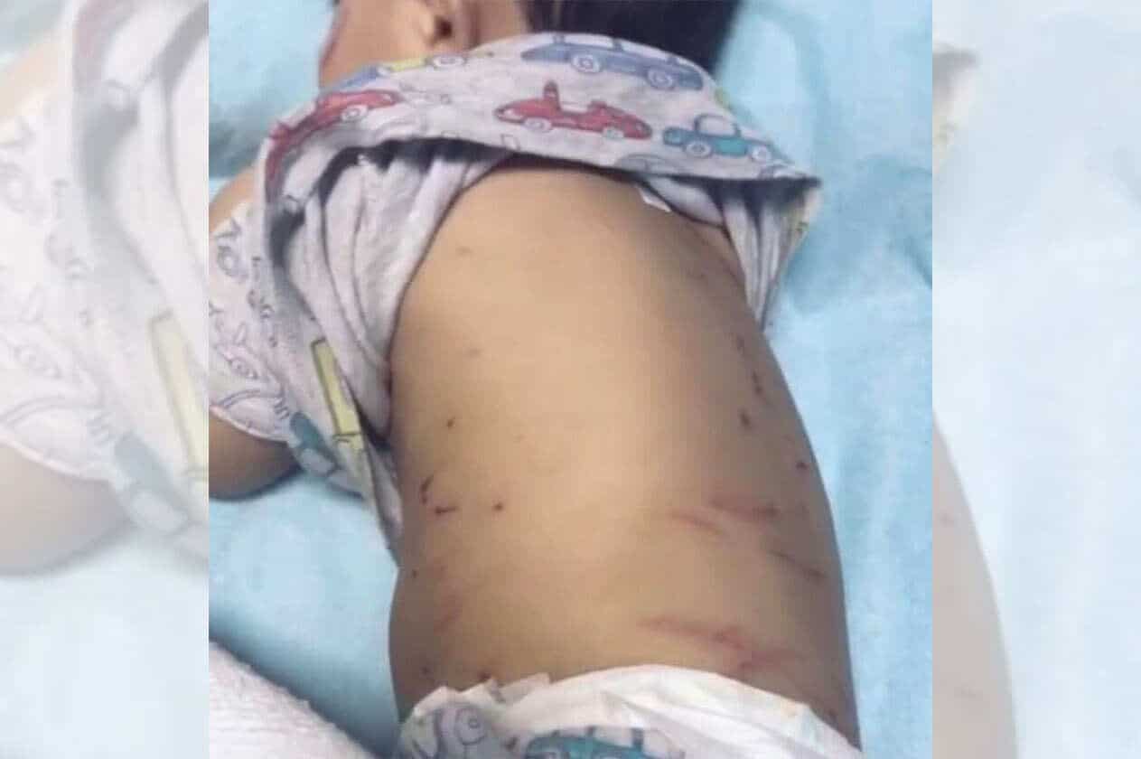 نقل طفل للمستشفى بعد هجوم الكلاب عليه بالدمام 