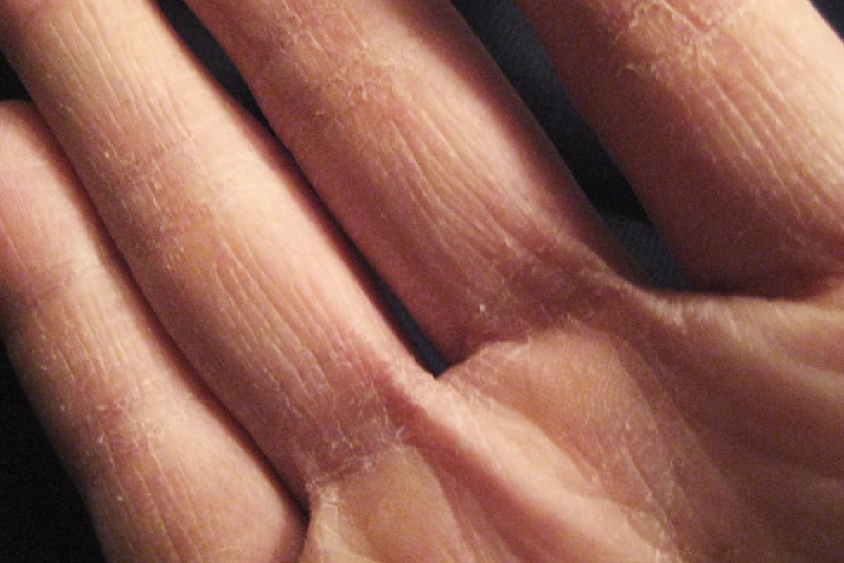 تخلصي من تشقق الأيدي فى فصل الشتاء نهائيا