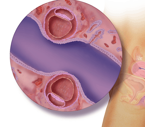 الأسبوع الثالث للتوأم داخل الرحم الأسبوع الثالث للتوأم داخل الرحم