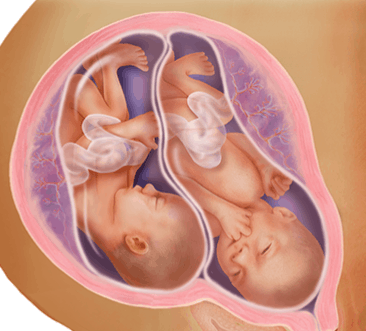 الأسبوع الثلاثين للتوأم داخل الرحم الأسبوع الثلاثين للتوأم داخل الرحم