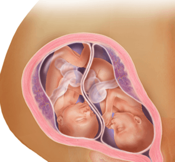 الأسبوع الرابع والعشرين للتوأم داخل الرحم الأسبوع الرابع والعشرين للتوأم داخل الرحم