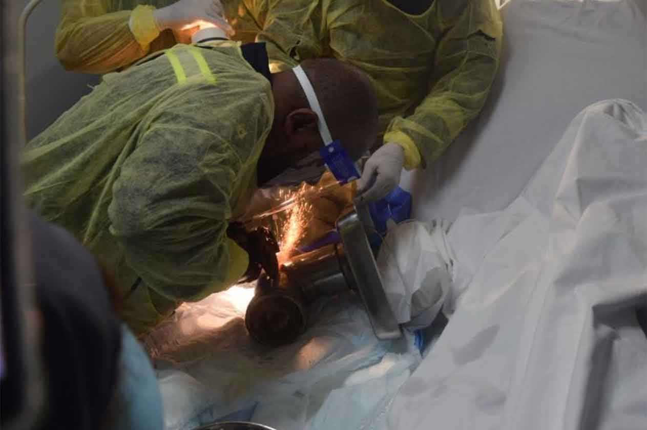 إنقاذ يد سيدة من داخل فرامة لحوم بالرياض