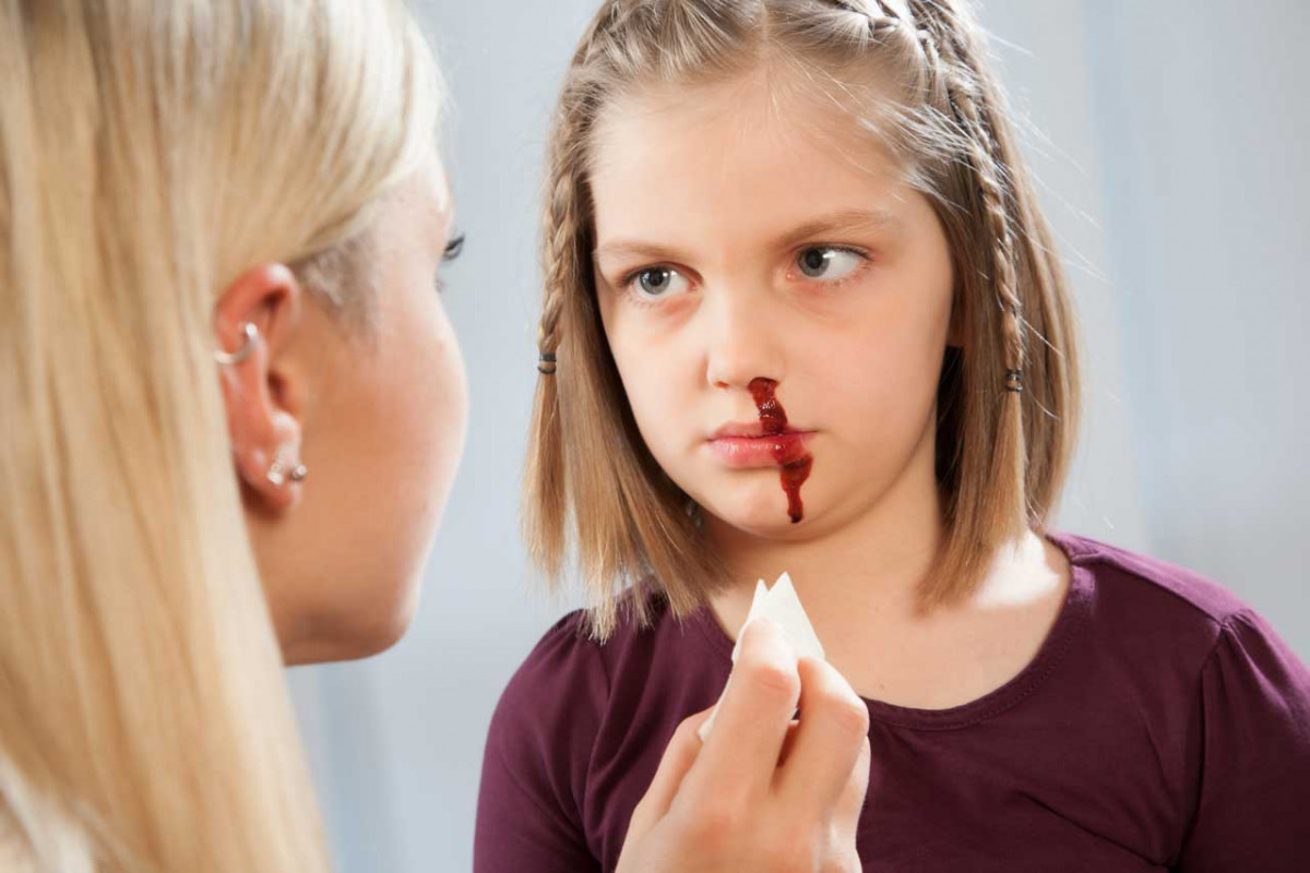 ما هو سبب الرعاف عند الاطفال وعلاجه مجرب