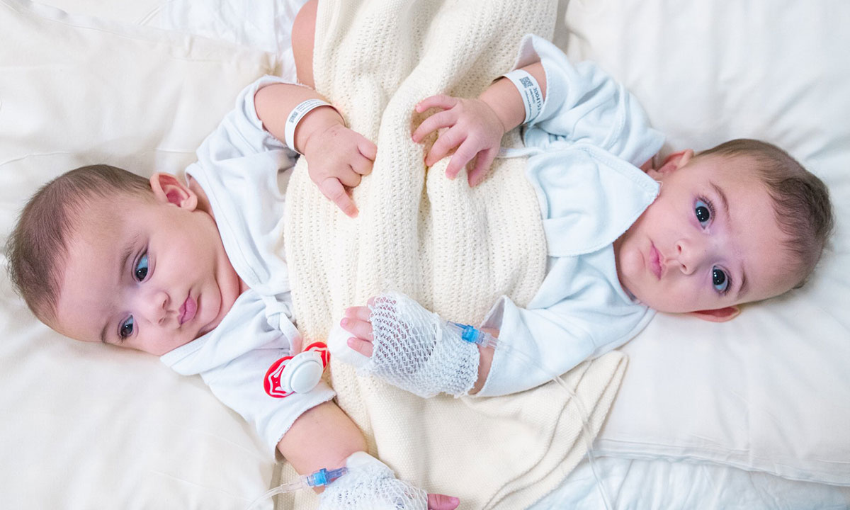 هاشتاق فصل التوأم السيامي الليبي يتصدر الترند في السعودية