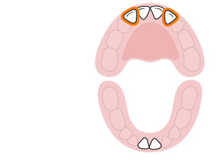 3 ـ القواطع العلوية الجانبية 3 ـ القواطع العلوية الجانبية