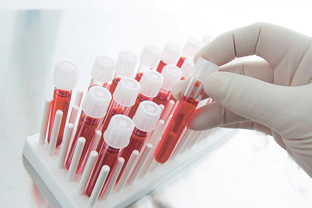 اعراض حساسية الدم وعلاجها