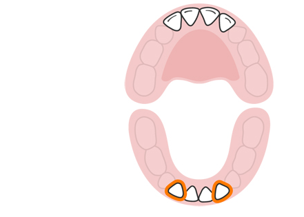 4 ـ القواطع الجانبية السفلية 4 ـ القواطع الجانبية السفلية