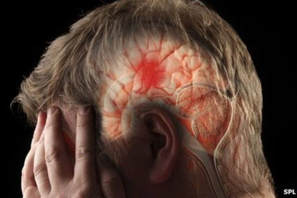 علامات حدوث الجلطة