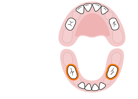  6 ـ الأسنان الطاحنة السفلية الأولى (الضروس السفلية الأولى)