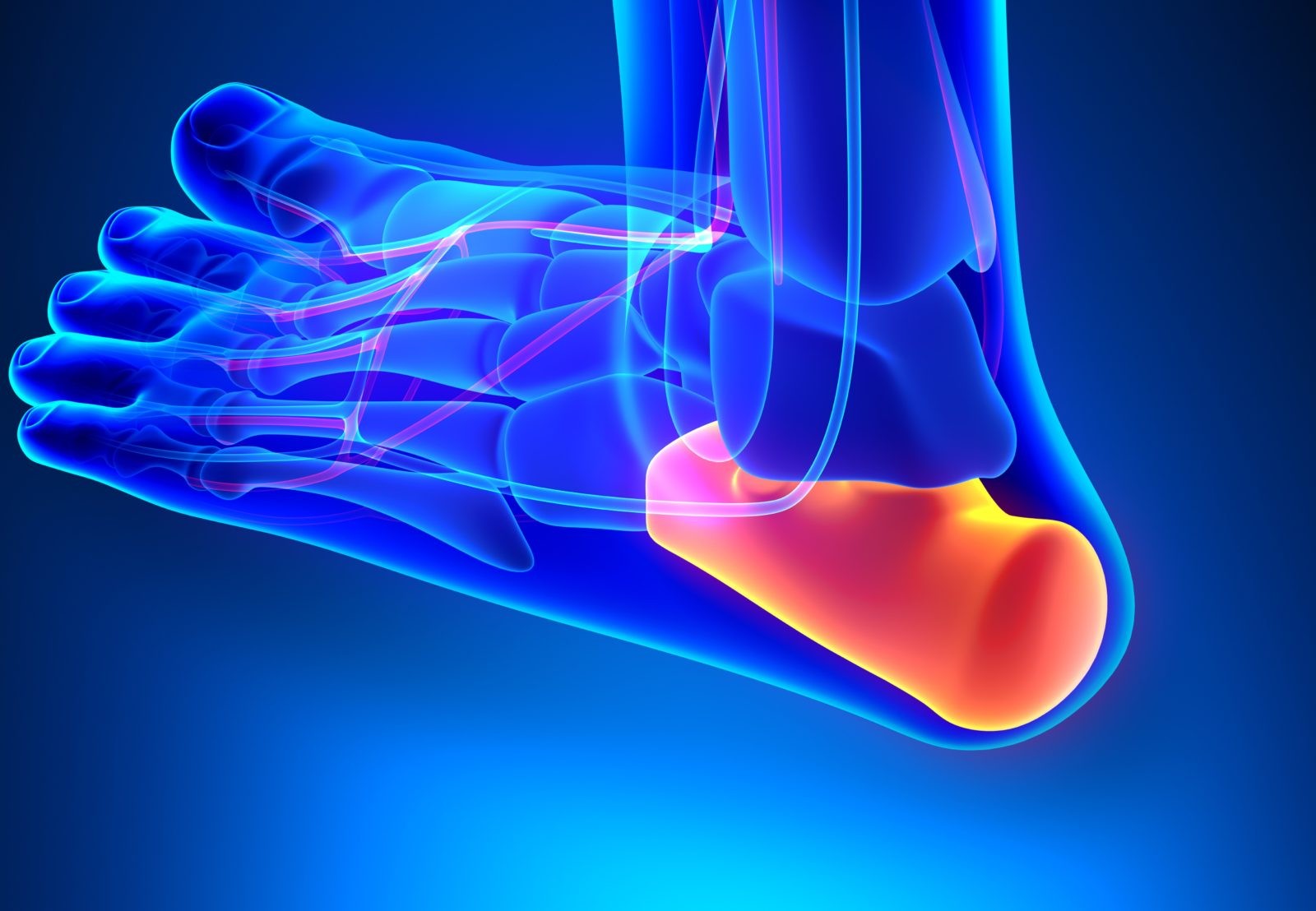 ما هي اسباب الشوكة العظمية واعراضها وعلاجها