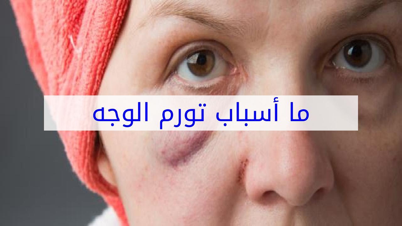 ما هي أسباب انتفاخ الوجه