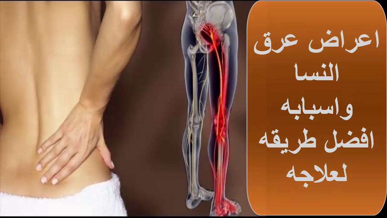 أسباب التهاب العصب الوركي وأعراضه وطرق علاجه