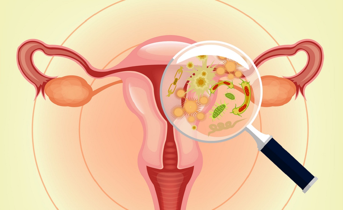طرق علاج التهابات المهبل بالاعشاب