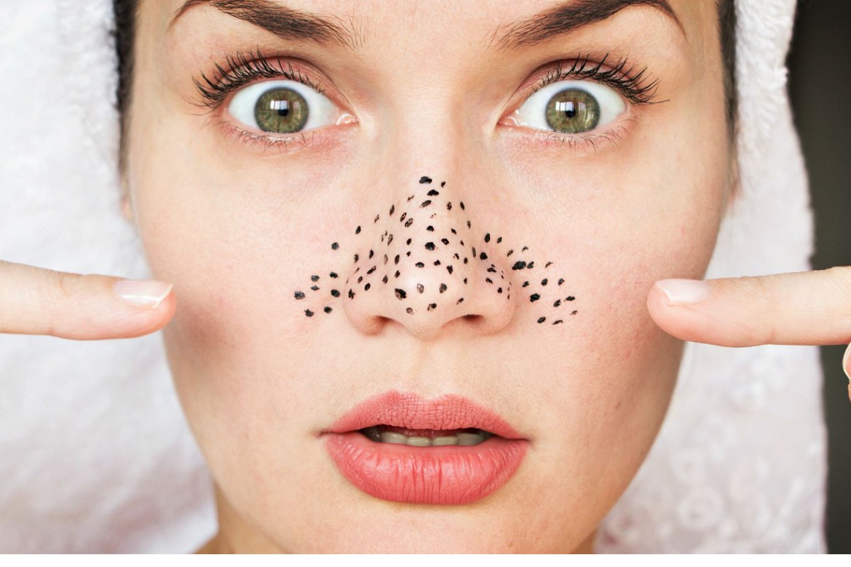 كيفية ازالة الرؤوس السوداء من الوجه