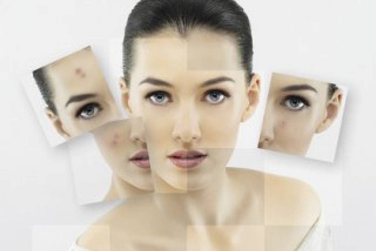 فيما يستخدم كريم هاي كوين