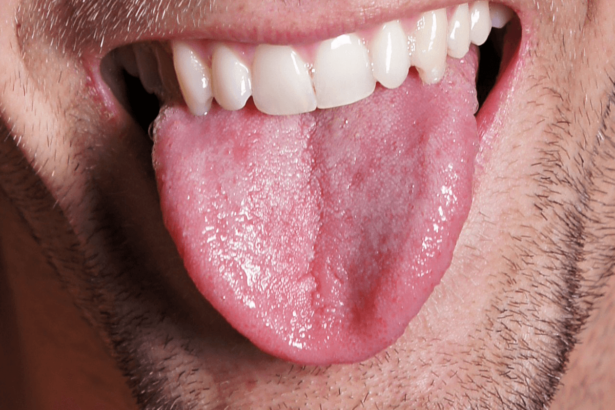 بلع اللسان الأسباب وطرق الإنقاذ السريعة