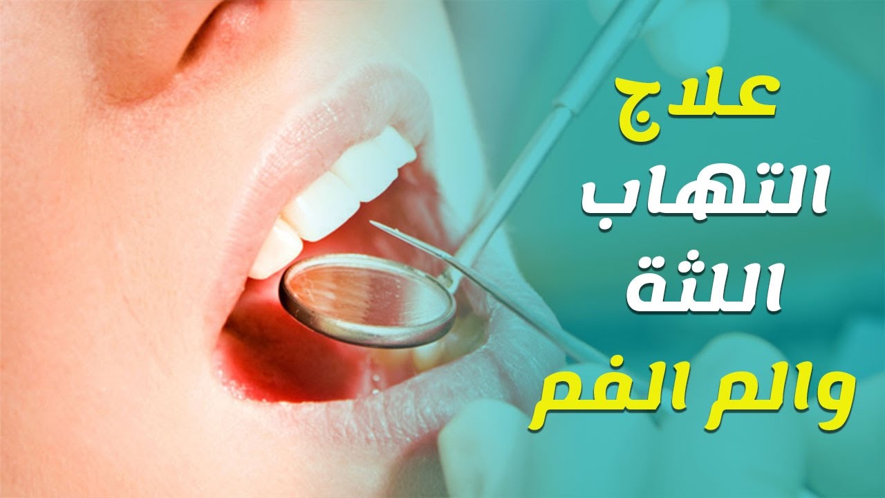 ماهو علاج اللثة الملتهبه