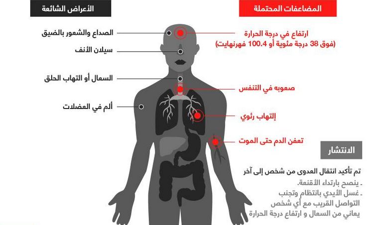 كيف اعرف انى مصاب بفيروس كورونا أعراض مرض كورونا
