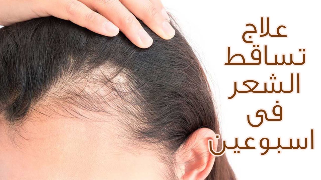  9 خلطات لعلاج تساقط الشعر 2021