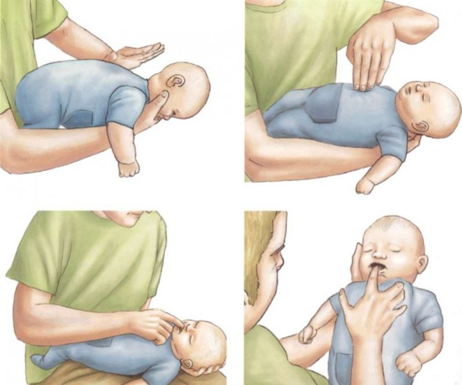 ما هو علاج الشرقة المتكررة