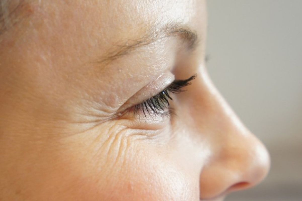 التجاعيد كيف ازالتها أسرع علاج للتجاعيد في البشرة والعين مجرب